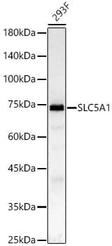 Western Blot: SGLT1/SLC5A1 Antibody [NBP3-35198] - Western blot analysis of lysates from 293F cells, using SGLT1/SLC5A1 Rabbit pAb at 1:1000 dilution.Secondary antibody: HRP-conjugated Goat anti-Rabbit IgG (H+L) at 1:10000 dilution.Lysates/proteins: 25ug per lane.Blocking buffer: 3% nonfat dry milk in TBST.Detection: ECL Basic Kit.Exposure time: 45s.