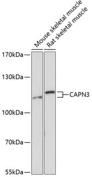 Western Blot Calpain 3 Antibody