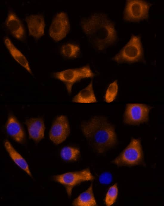 Immunocytochemistry/ Immunofluorescence Calpain 3 Antibody