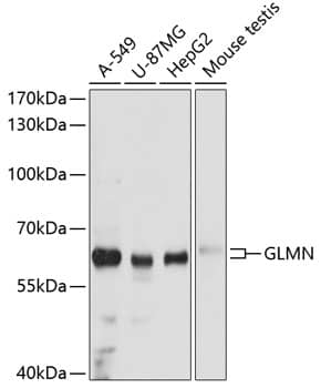 Western Blot: GLMN Antibody [NBP3-35201] - Western blot analysis of various lysates using GLMN Rabbit pAb at 1:3000 dilution.Secondary antibody: HRP-conjugated Goat anti-Rabbit IgG (H+L) at 1:10000 dilution.Lysates/proteins: 25ug per lane.Blocking buffer: 3% nonfat dry milk in TBST.Detection: ECL Basic Kit.Exposure time: 10s.