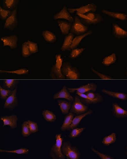 Immunocytochemistry/ Immunofluorescence: PDE6D Antibody [NBP3-35202] - Immunofluorescence analysis of U-2 OS cells using PDE6D Rabbit pAb at dilution of 1:100 (40x lens). Secondary antibody: Cy3-conjugated Goat anti-Rabbit IgG (H+L) at 1:500 dilution. Blue: DAPI for nuclear staining.
