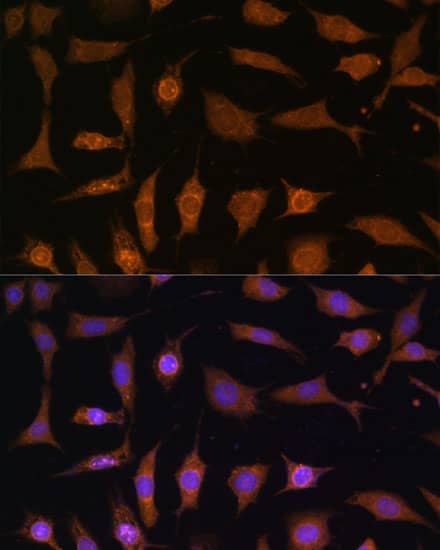 Immunocytochemistry/ Immunofluorescence: PDE6D Antibody [NBP3-35202] - Immunofluorescence analysis of L929 cells using PDE6D Rabbit pAb at dilution of 1:100 (40x lens). Secondary antibody: Cy3-conjugated Goat anti-Rabbit IgG (H+L) at 1:500 dilution. Blue: DAPI for nuclear staining.
