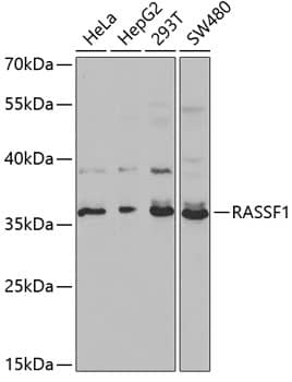 Western Blot: RASSF1 Antibody [NBP3-35204] - Western blot analysis of various lysates using RASSF1 Rabbit pAb at 1:1000 dilution.Secondary antibody: HRP-conjugated Goat anti-Rabbit IgG (H+L) at 1:10000 dilution.Lysates/proteins: 25ug per lane.Blocking buffer: 3% nonfat dry milk in TBST.