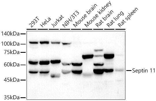 Western Blot: Septin-11 Antibody [NBP3-35205] - Western blot analysis of various lysates using Septin-11 Rabbit pAb at  1:5000 dilution.Secondary antibody: HRP-conjugated Goat anti-Rabbit IgG (H+L) at 1:10000 dilution.Lysates/proteins: 25ug per lane.Blocking buffer: 3% nonfat dry milk in TBST.Detection: ECL Basic Kit.Exposure time: 90s.