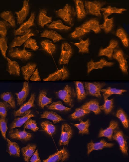 Immunocytochemistry/ Immunofluorescence: SPRR3 Antibody [NBP3-35206] - Immunofluorescence analysis of U2OS cells using SPRR3 Rabbit pAb at dilution of 1:100 (40x lens). Secondary antibody: Cy3-conjugated Goat anti-Rabbit IgG (H+L) at 1:500 dilution. Blue: DAPI for nuclear staining.