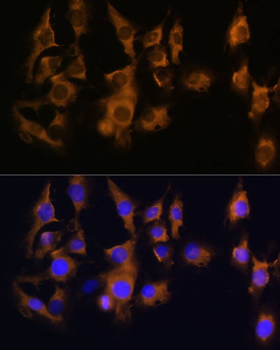 Immunocytochemistry/ Immunofluorescence: SPRR3 Antibody [NBP3-35206] - Immunofluorescence analysis of C6 cells using SPRR3 Rabbit pAb at dilution of 1:100 (40x lens). Secondary antibody: Cy3-conjugated Goat anti-Rabbit IgG (H+L) at 1:500 dilution. Blue: DAPI for nuclear staining.