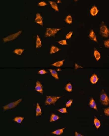 Immunocytochemistry/ Immunofluorescence: SPRR3 Antibody [NBP3-35206] - Immunofluorescence analysis of L929 cells using SPRR3 Rabbit pAb at dilution of 1:100. Secondary antibody: Cy3-conjugated Goat anti-Rabbit IgG (H+L) at 1:500 dilution. Blue: DAPI for nuclear staining.