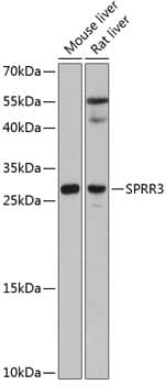 Western Blot: SPRR3 Antibody [NBP3-35206] - Western blot analysis of various lysates using SPRR3 Rabbit pAb at 1:3000 dilution.Secondary antibody: HRP-conjugated Goat anti-Rabbit IgG (H+L) at 1:10000 dilution.Lysates/proteins: 25ug per lane.Blocking buffer: 3% nonfat dry milk in TBST.Detection: ECL Basic Kit.Exposure time: 90s.