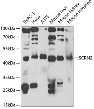 Western Blot: SCRN2 Antibody [NBP3-35207] - Western blot analysis of various lysates using SCRN2 Rabbit pAb at 1:1000 dilution.Secondary antibody: HRP-conjugated Goat anti-Rabbit IgG (H+L) at 1:10000 dilution.Lysates/proteins: 25ug per lane.Blocking buffer: 3% nonfat dry milk in TBST.