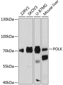 Western Blot: DNA Polymerase Kappa Antibody [NBP3-35208] - Western blot analysis of various lysates using DNA Polymerase Kappa Rabbit pAb at 1:1000 dilution.Secondary antibody: HRP-conjugated Goat anti-Rabbit IgG (H+L) at 1:10000 dilution.Lysates/proteins: 25ug per lane.Blocking buffer: 3% nonfat dry milk in TBST.Detection: ECL Basic Kit.Exposure time: 5s.