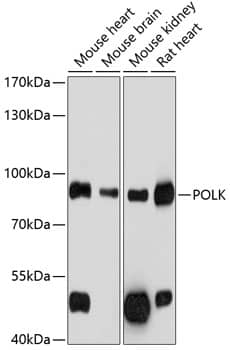 Western Blot: DNA Polymerase Kappa Antibody [NBP3-35208] - Western Blot analysis of various lysates using DNA Polymerase Kappa Rabbit pAb at 1:1000 dilution.Secondary antibody: HRP-conjugated Goat anti-Rabbit IgG (H+L) at 1:10000 dilution.Lysates/proteins: 25ug per lane.Blocking buffer: 3% nonfat dry milk in TBST.Detection: ECL Basic Kit.Exposure time: 5s.