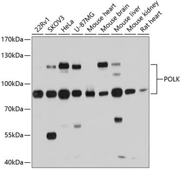 Western Blot: DNA Polymerase Kappa Antibody [NBP3-35208] - Western Blot analysis of various lysates using DNA Polymerase Kappa Rabbit pAb at 1:1000 dilution.Secondary antibody: HRP-conjugated Goat anti-Rabbit IgG (H+L) at 1:10000 dilution.Lysates/proteins: 25ug per lane.Blocking buffer: 3% nonfat dry milk in TBST.Detection: ECL Basic Kit.Exposure time: 5s.