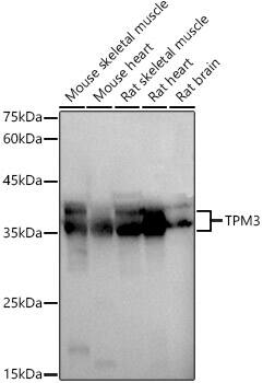 Western Blot: tropomyosin-3 Antibody [NBP3-35209] - Western blot analysis of various lysates using tropomyosin-3 Rabbit pAb at  1:1000 dilution.Secondary antibody: HRP-conjugated Goat anti-Rabbit IgG (H+L) at 1:10000 dilution.Lysates/proteins: 25ug per lane.Blocking buffer: 3% nonfat dry milk in TBST.Detection: ECL Basic Kit.Exposure time: 3s.