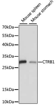 Western Blot: CTRB1 Antibody [NBP3-35211] - Western blot analysis of various lysates using CTRB1 Rabbit pAb at 1:1000 dilution.Secondary antibody: HRP-conjugated Goat anti-Rabbit IgG (H+L) at 1:10000 dilution.Lysates/proteins: 25ug per lane.Blocking buffer: 3% nonfat dry milk in TBST.Detection: ECL Basic Kit.Exposure time: 5s.