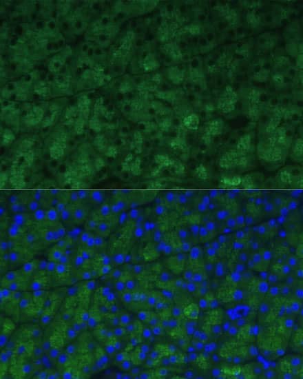 Immunocytochemistry/ Immunofluorescence: CTRB1 Antibody [NBP3-35211] - Immunofluorescence analysis of paraffin-embedded mouse pancreas using CTRB1 Rabbit pAb at dilution of 1:100 (40x lens). Secondary antibody: Cy3-conjugated Goat anti-Rabbit IgG (H+L) at 1:500 dilution. Blue: DAPI for nuclear staining.