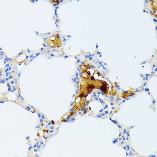 Immunohistochemistry CTRB1 Antibody - BSA Free