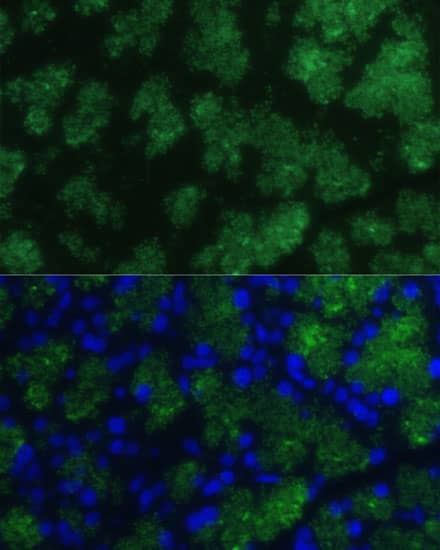 Immunocytochemistry/ Immunofluorescence: CTRB1 Antibody [NBP3-35211] - Immunofluorescence analysis of paraffin-embedded rat pancreas using CTRB1 Rabbit pAb at dilution of 1:100 (40x lens). Secondary antibody: Cy3-conjugated Goat anti-Rabbit IgG (H+L) at 1:500 dilution. Blue: DAPI for nuclear staining.