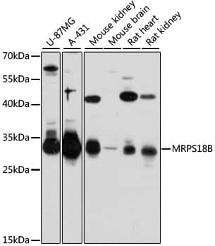 Western Blot: MRPS18B Antibody [NBP3-35212] - Western blot analysis of various lysates using MRPS18B Rabbit pAb at 1:3000 dilution.Secondary antibody: HRP-conjugated Goat anti-Rabbit IgG (H+L) at 1:10000 dilution.Lysates/proteins: 25ug per lane.Blocking buffer: 3% nonfat dry milk in TBST.Detection: ECL Basic Kit.Exposure time: 30s.