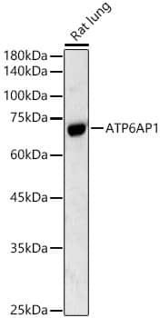 Western Blot: ATP6AP1 Antibody [NBP3-35213] - Western blot analysis of lysates from Rat lung, using ATP6AP1 Rabbit pAb at  1:500 dilution.Secondary antibody: HRP-conjugated Goat anti-Rabbit IgG (H+L) at 1:10000 dilution.Lysates/proteins: 25ug per lane.Blocking buffer: 3% nonfat dry milk in TBST.Detection: ECL Basic Kit.Exposure time: 90s.