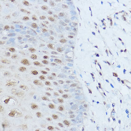 Immunohistochemistry SMARCD2 Antibody