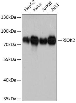 Western Blot: RIOK2 Antibody [NBP3-35219] - Western blot analysis of various lysates using RIOK2 Rabbit pAb at 1:3000 dilution.Secondary antibody: HRP-conjugated Goat anti-Rabbit IgG (H+L) at 1:10000 dilution.Lysates/proteins: 25ug per lane.Blocking buffer: 3% nonfat dry milk in TBST.Detection: ECL Basic Kit.Exposure time: 90s.