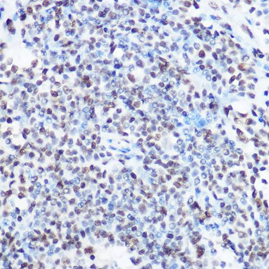 Immunohistochemistry: SART3 Antibody [NBP3-35220] - Immunohistochemistry analysis of paraffin-embedded Human lymph node using SART3 Rabbit pAb at dilution of 1:100 (40x lens). High pressure antigen retrieval performed with 0.01M Citrate Bufferr (pH 6.0) prior to IHC staining.