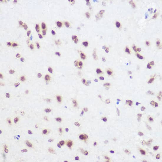 Immunohistochemistry: SART3 Antibody [NBP3-35220] - Immunohistochemistry analysis of paraffin-embedded Rat brain using SART3 Rabbit pAb at dilution of 1:100 (40x lens). High pressure antigen retrieval performed with 0.01M Citrate Bufferr (pH 6.0) prior to IHC staining.