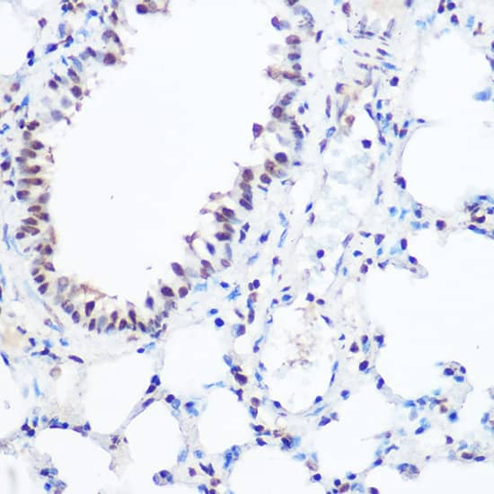 Immunohistochemistry: SART3 Antibody [NBP3-35220] - Immunohistochemistry analysis of paraffin-embedded Mouse lung using SART3 Rabbit pAb at dilution of 1:100 (40x lens). High pressure antigen retrieval performed with 0.01M Citrate Bufferr (pH 6.0) prior to IHC staining.