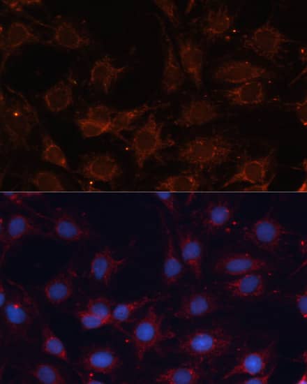 Immunocytochemistry/ Immunofluorescence: SLC25A24 Antibody [NBP3-35221] - Immunofluorescence analysis of C6 cells using SLC25A24 Rabbit pAb at dilution of 1:100. Secondary antibody: Cy3-conjugated Goat anti-Rabbit IgG (H+L) at 1:500 dilution. Blue: DAPI for nuclear staining.