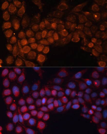 Immunocytochemistry/ Immunofluorescence: SLC25A24 Antibody [NBP3-35221] - Immunofluorescence analysis of HeLa cells using SLC25A24 Rabbit pAb at dilution of 1:100. Secondary antibody: Cy3-conjugated Goat anti-Rabbit IgG (H+L) at 1:500 dilution. Blue: DAPI for nuclear staining.