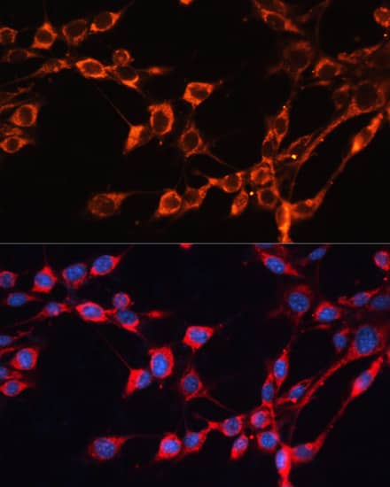 Immunocytochemistry/ Immunofluorescence: SLC25A24 Antibody [NBP3-35221] - Immunofluorescence analysis of NIH/3T3 cells using SLC25A24 Rabbit pAb at dilution of 1:100. Secondary antibody: Cy3-conjugated Goat anti-Rabbit IgG (H+L) at 1:500 dilution. Blue: DAPI for nuclear staining.