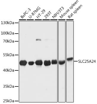 Western Blot: SLC25A24 Antibody [NBP3-35221] - Western blot analysis of various lysates using SLC25A24 Rabbit pAb at 1:1000 dilution.Secondary antibody: HRP-conjugated Goat anti-Rabbit IgG (H+L) at 1:10000 dilution.Lysates/proteins: 25ug per lane.Blocking buffer: 3% nonfat dry milk in TBST.Detection: ECL Basic Kit.Exposure time: 1s.