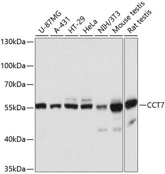 Western Blot: TCP1-eta Antibody [NBP3-35222] - Western blot analysis of various lysates using TCP1-eta Rabbit pAb at 1:3000 dilution.Secondary antibody: HRP-conjugated Goat anti-Rabbit IgG (H+L) at 1:10000 dilution.Lysates/proteins: 25ug per lane.Blocking buffer: 3% nonfat dry milk in TBST.Detection: ECL Basic Kit.Exposure time: 1s.