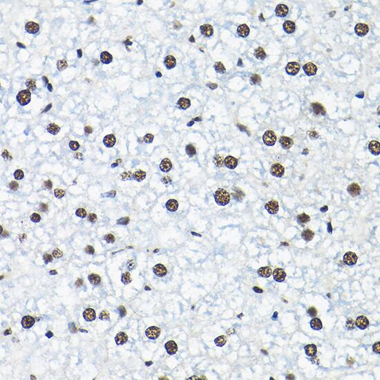 Immunohistochemistry: SNRPA1 Antibody [NBP3-35226] - Immunohistochemistry analysis of paraffin-embedded Mouse liver using SNRPA1 Rabbit pAb at dilution of 1:200 (40x lens). High pressure antigen retrieval performed with 0.01M Citrate Bufferr (pH 6.0) prior to IHC staining.