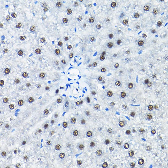 Immunohistochemistry: SNRPA1 Antibody [NBP3-35226] - Immunohistochemistry analysis of paraffin-embedded Rat liver using SNRPA1 Rabbit pAb at dilution of 1:200 (40x lens). High pressure antigen retrieval performed with 0.01M Citrate Bufferr (pH 6.0) prior to IHC staining.