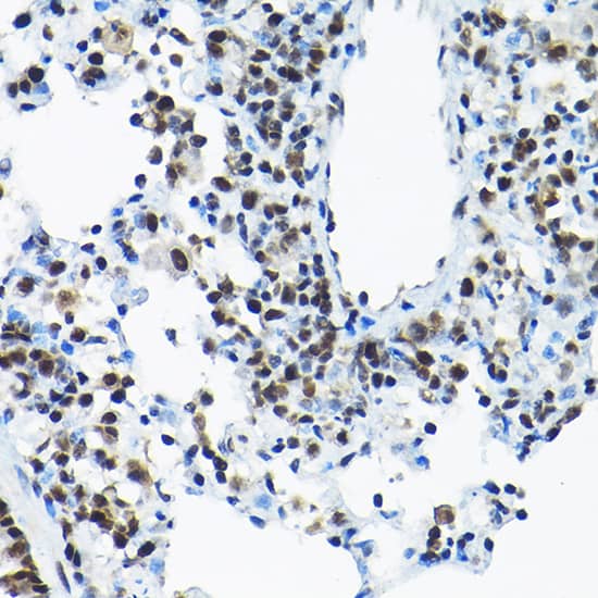 Immunohistochemistry: SNRPA1 Antibody [NBP3-35226] - Immunohistochemistry analysis of paraffin-embedded Rat lung using SNRPA1 Rabbit pAb at dilution of 1:200 (40x lens). High pressure antigen retrieval performed with 0.01M Citrate Bufferr (pH 6.0) prior to IHC staining.