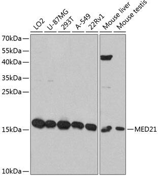 Western Blot: MED21 Antibody [NBP3-35228] - Western blot analysis of various lysates using MED21 Rabbit pAb at 1:3000 dilution.Secondary antibody: HRP-conjugated Goat anti-Rabbit IgG (H+L) at 1:10000 dilution.Lysates/proteins: 25ug per lane.Blocking buffer: 3% nonfat dry milk in TBST.Detection: ECL Basic Kit.Exposure time: 60s.