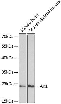 Western Blot: Adenylate Kinase 1 Antibody [NBP3-35229] - Western blot analysis of various lysates using Adenylate Kinase 1 Rabbit pAb at 1:1000 dilution.Secondary antibody: HRP-conjugated Goat anti-Rabbit IgG (H+L) at 1:10000 dilution.Lysates/proteins: 25ug per lane.Blocking buffer: 3% nonfat dry milk in TBST.