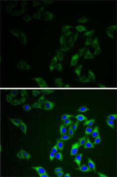 Immunocytochemistry/ Immunofluorescence: Adenylate Kinase 1 Antibody [NBP3-35229] - Immunofluorescence analysis of HeLa cells using Adenylate Kinase 1 Rabbit pAb. Secondary antibody: Cy3-conjugated Goat anti-Rabbit IgG (H+L) at 1:500 dilution. Blue: DAPI for nuclear staining.