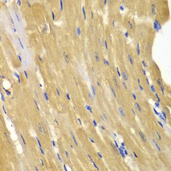 Immunohistochemistry: Adenylate Kinase 1 Antibody [NBP3-35229] - Immunohistochemistry analysis of paraffin-embedded Mouse heart using Adenylate Kinase 1 Rabbit pAb at dilution of 1:100 (40x lens). Microwave antigen retrieval performed with 0.01M PBS Buffer (pH 7.2) prior to IHC staining.