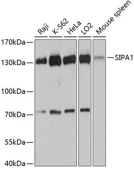 Western Blot: SIPA1 Antibody [NBP3-35235] - Western blot analysis of various lysates using SIPA1 Rabbit pAb at 1:3000 dilution.Secondary antibody: HRP-conjugated Goat anti-Rabbit IgG (H+L) at 1:10000 dilution.Lysates/proteins: 25ug per lane.Blocking buffer: 3% nonfat dry milk in TBST.Detection: ECL Basic Kit.Exposure time: 90s.