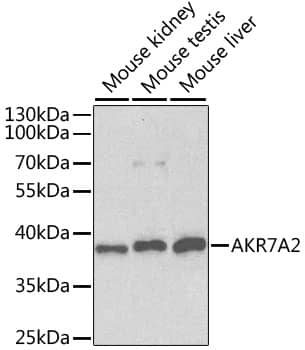 Western Blot: AKR7A2 Antibody [NBP3-35236] - Western blot analysis of various lysates using AKR7A2 Rabbit pAb at 1:1000 dilution.Secondary antibody: HRP-conjugated Goat anti-Rabbit IgG (H+L) at 1:10000 dilution.Lysates/proteins: 25ug per lane.Blocking buffer: 3% nonfat dry milk in TBST.Detection: ECL Basic Kit.