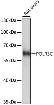 Western Blot: RPC62 Antibody [NBP3-35239] - Western blot analysis of lysates from rat ovary, using RPC62 Rabbit pAb at 1:1000 dilution.Secondary antibody: HRP-conjugated Goat anti-Rabbit IgG (H+L) at 1:10000 dilution.Lysates/proteins: 25ug per lane.Blocking buffer: 3% nonfat dry milk in TBST.Detection: ECL Basic Kit.Exposure time: 10s.