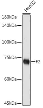 Western Blot: Prothrombin Antibody [NBP3-35241] - Western blot analysis of lysates from HepG2 cells, using Prothrombin Rabbit pAb at 1:500 dilution.Secondary antibody: HRP-conjugated Goat anti-Rabbit IgG (H+L) at 1:10000 dilution.Lysates/proteins: 25ug per lane.Blocking buffer: 3% nonfat dry milk in TBST.Detection: ECL Basic Kit.Exposure time: 180s.