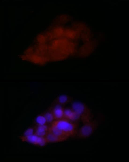 Immunocytochemistry/ Immunofluorescence: TIA1 Antibody [NBP3-35245] - Immunofluorescence analysis of HepG2 cells using TIA1 Rabbit pAb at dilution of 1:100 (40x lens). Secondary antibody: Cy3-conjugated Goat anti-Rabbit IgG (H+L) at 1:500 dilution. Blue: DAPI for nuclear staining.