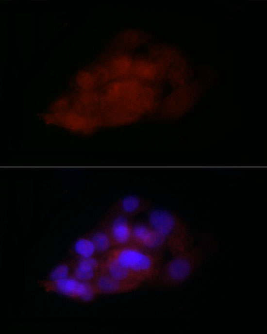 Immunocytochemistry/ Immunofluorescence: TIA1 Antibody [NBP3-35245] - Immunofluorescence analysis of HepG2 cells using TIA1 Rabbit pAb at dilution of 1:100 (40x lens). Blue: DAPI for nuclear staining.