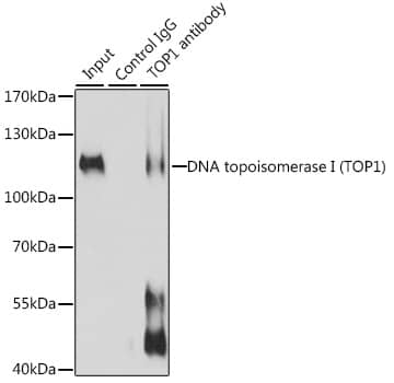 Immunoprecipitation: Topoisomerase I Antibody [NBP3-35246] - Immunoprecipitation analysis of 200 ug extracts of Jurkat cells, using 3 ug Topoisomerase I(Topoisomerase I(TOP1)) antibody. Western blot was performed from the immunoprecipitate using Topoisomerase I(Topoisomerase I(TOP1)) antibody at a dilution of 1:1000.