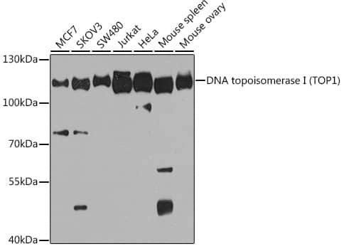 Western Blot: Topoisomerase I Antibody [NBP3-35246] - Western blot analysis of various lysates using Topoisomerase I(TOP1) Rabbit pAb at 1:1000 dilution.Secondary antibody: HRP-conjugated Goat anti-Rabbit IgG (H+L) at 1:10000 dilution.Lysates/proteins: 25ug per lane.Blocking buffer: 3% nonfat dry milk in TBST.Detection: ECL Basic Kit.Exposure time: 90s.