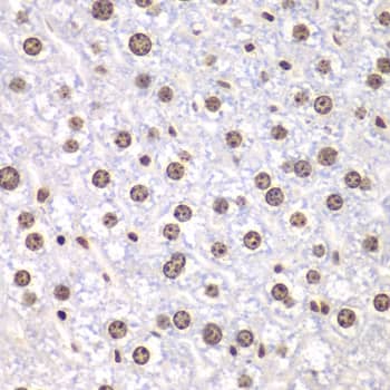 Immunohistochemistry: Topoisomerase I Antibody [NBP3-35246] - Immunohistochemistry analysis of paraffin-embedded Mouse liver using Topoisomerase I(TOP1) Rabbit pAb at dilution of 1:100 (40x lens). Microwave antigen retrieval performed with 0.01M PBS Buffer (pH 7.2) prior to IHC staining.