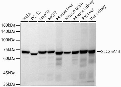 Western Blot: SLC25A13 Antibody [NBP3-35249] - Western blot analysis of various lysates using SLC25A13 Rabbit pAb at 1:1000 dilution.Secondary antibody: HRP-conjugated Goat anti-Rabbit IgG (H+L) at 1:10000 dilution.Lysates/proteins: 25ug per lane.Blocking buffer: 3% nonfat dry milk in TBST.Detection: ECL Basic Kit.Exposure time: 30s.